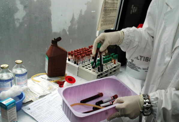 Epatite A in aumento in Italia, segnalati diversi casi anche in Calabria Schermata-2026-03-20-alle-17.59.15_8e66a.jpg